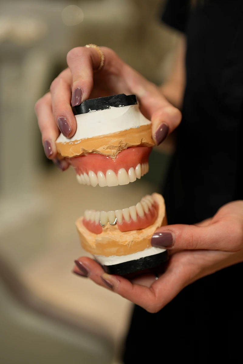 Upper and lower acrylic dentures