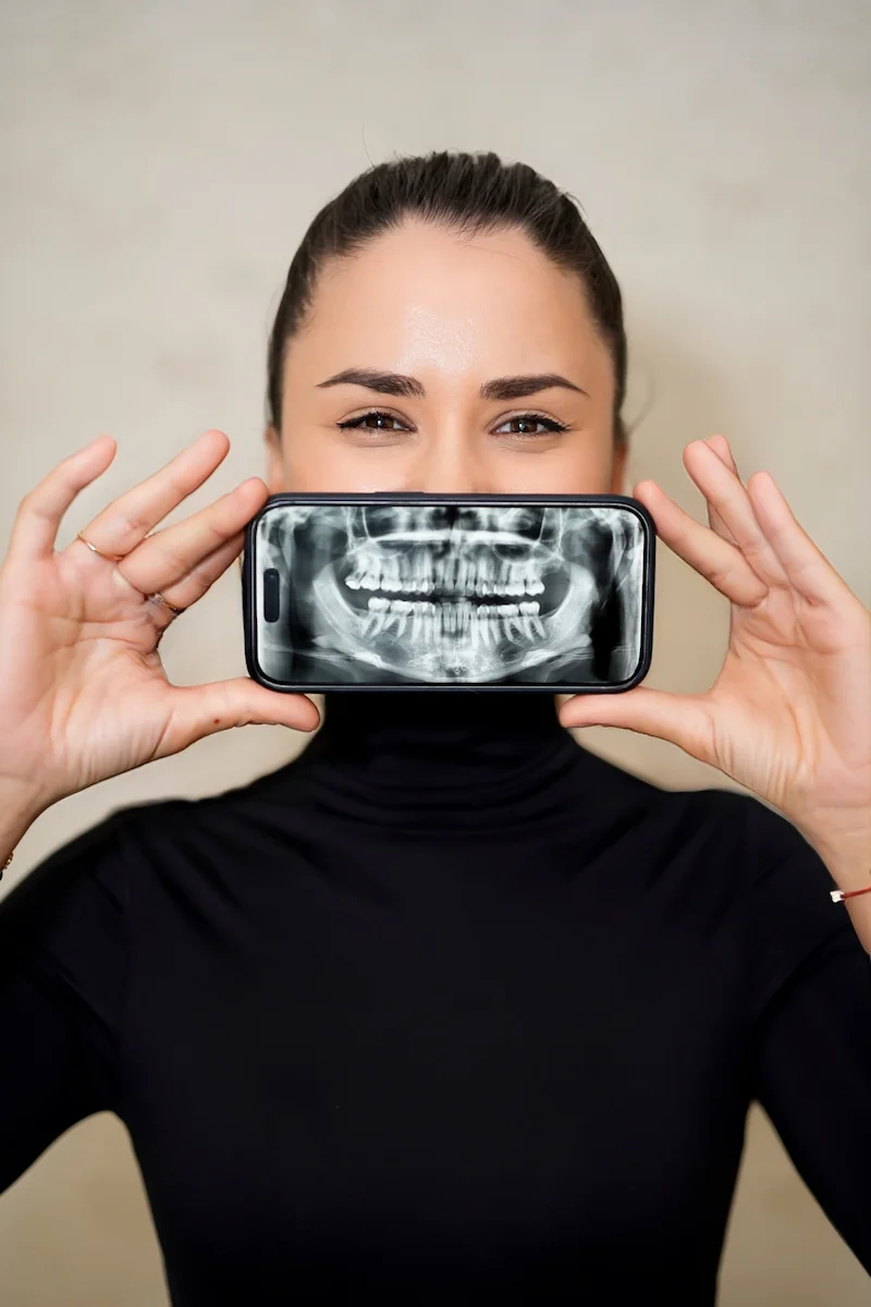 Wisdom teeth coming through at an angle? When extraction is recommended